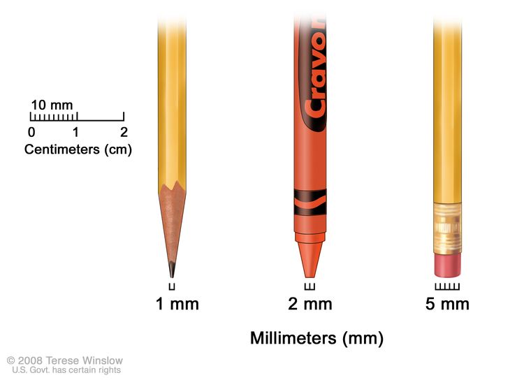 Millimeters; drawing shows millimeters (mm) using everyday objects. A sharp pencil point shows 1 mm, a new crayon point shows 2 mm, and a new pencil-top eraser shows 5 mm. Millimeters; drawing shows millimeters (mm) using everyday objects. A sharp pencil point shows 1 mm, a new crayon point shows 2 mm, and a new pencil-top eraser shows 5 mm.